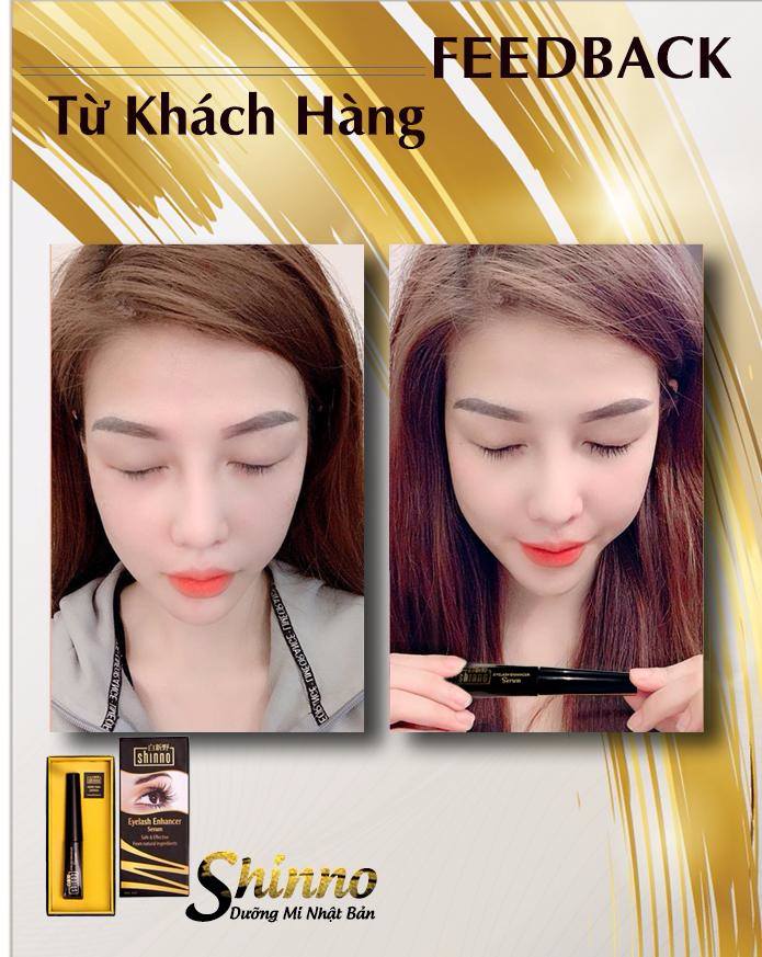 Chị Phương -35 tuổi