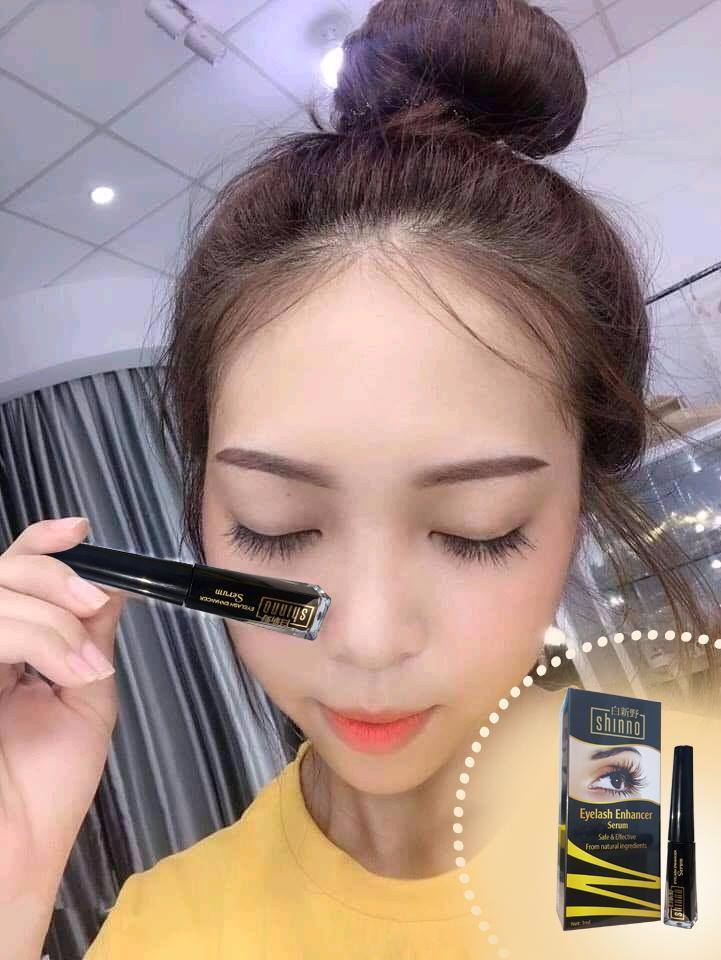 Chị Ngân - 20 Tuổi