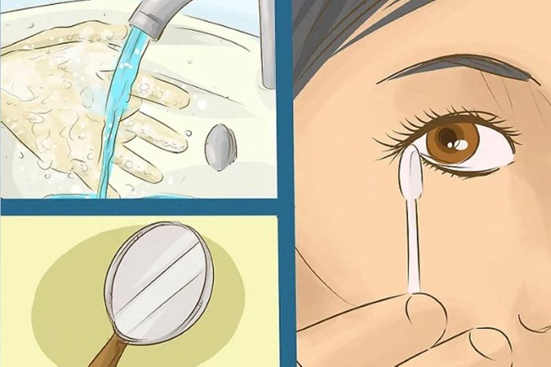 Nguyên nhân lông mi rơi vào mắt