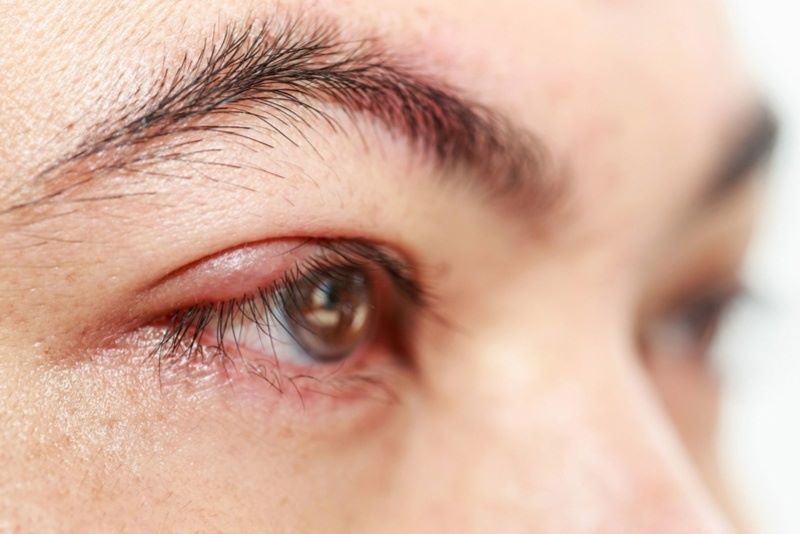 Tác hại khi lông mi không được lấy ra khỏi mắt